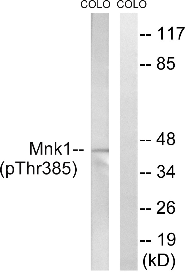 MKNK1 / MNK1 Antibody - Western blot analysis of lysates from COLO205 cells treated with PMA 125ng/ml 30', using Mnk1 (Phospho-Thr385) Antibody. The lane on the right is blocked with the phospho peptide.