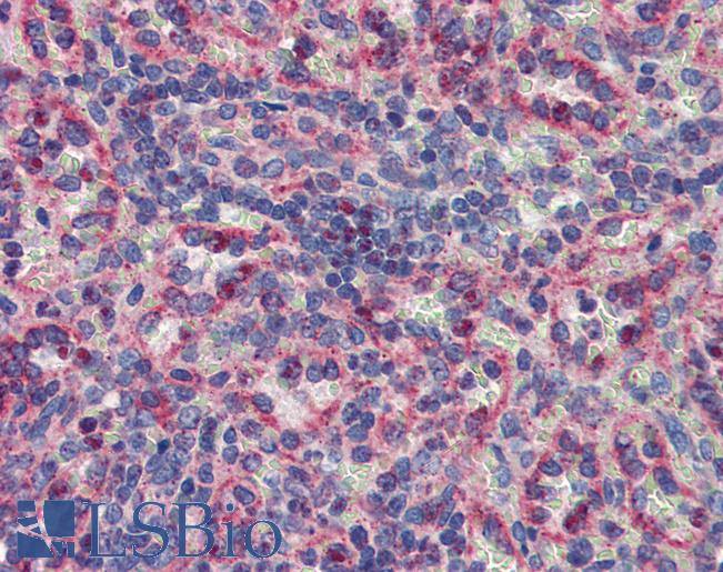 MKNK2 / MNK2 Antibody - Anti-MKNK2 / MNK2 antibody IHC of human spleen. Immunohistochemistry of formalin-fixed, paraffin-embedded tissue after heat-induced antigen retrieval. Antibody concentration 5 ug/ml.  This image was taken for the unconjugated form of this product. Other forms have not been tested.