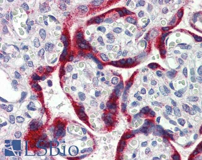 MKNK2 / MNK2 Antibody - Anti-MKNK2 / MNK2 antibody IHC of human placenta. Immunohistochemistry of formalin-fixed, paraffin-embedded tissue after heat-induced antigen retrieval. Antibody concentration 5 ug/ml.  This image was taken for the unconjugated form of this product. Other forms have not been tested.