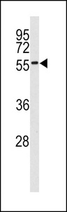 MKNK2 / MNK2 Antibody - Western blot of MNK2 (MKNK2) antibody in 293 cell line lysates (35 ug/lane). MNK2 (arrow) was detected using the purified antibody.