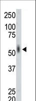 MKNK2 / MNK2 Antibody - The anti-MKNK2 antibody is used in Western blot to detect MKNK2 in mouse lung tissue lysate.