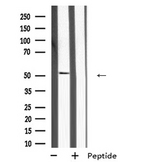MKNK2 / MNK2 Antibody - Western blot analysis of MKNK2 expression in A431 whole cells lysate. The lane on the left is treated with the antigen-specific peptide.