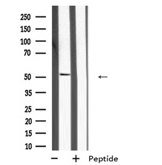 MKNK2 / MNK2 Antibody - Western blot analysis of MKNK2 expression in A431 whole cells lysate. The lane on the left is treated with the antigen-specific peptide.