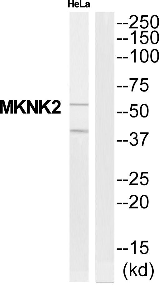 MKNK2 / MNK2 Antibody - Western blot analysis of extracts from HeLa cells, using MNK2 antibody.