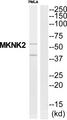 MKNK2 / MNK2 Antibody - Western blot analysis of extracts from HeLa cells, using MNK2 antibody.