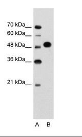 MKRN1 Antibody - A: Marker, B: Jurkat Cell Lysate.  This image was taken for the unconjugated form of this product. Other forms have not been tested.
