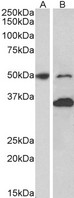 MKRN1 Antibody - Goat Anti-MKRN1 (aa105-118) Antibody (1µg/ml) staining of Mouse fetal (A) and adult (B) Brain lysates (35µg protein in RIPA buffer). Primary incubation was 1 hour. Detected by chemiluminescencence.