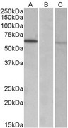 MKRN1 Antibody - MKRN1 antibody HEK293 lysate (10 ug protein in RIPA buffer) over expressing Human MKRN1 with DYKDDDDK tag probed with (0.3 ug/ml) in Lane A and probed with anti- DYKDDDDK Tag (1/1000) in lane C. Mock-transfected HEK293 probed with (1 mg/ml) in Lane B. Primary incubations were for 1 hour. Detected by chemiluminescence.