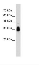 MKRN1 Antibody - Jurkat Cell Lysate.  This image was taken for the unconjugated form of this product. Other forms have not been tested.