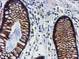 MKRN1 Antibody - IHC of paraffin-embedded Human colon tissue using anti-MKRN1 mouse monoclonal antibody.