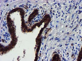 MKRN1 Antibody - IHC of paraffin-embedded Human prostate tissue using anti-MKRN1 mouse monoclonal antibody.