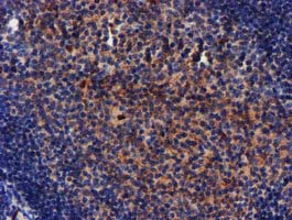 MKRN1 Antibody - IHC of paraffin-embedded Human tonsil using anti-MKRN1 mouse monoclonal antibody.