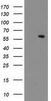 MKRN1 Antibody - HEK293T cells were transfected with the pCMV6-ENTRY control (Left lane) or pCMV6-ENTRY MKRN1 (Right lane) cDNA for 48 hrs and lysed. Equivalent amounts of cell lysates (5 ug per lane) were separated by SDS-PAGE and immunoblotted with anti-MKRN1.