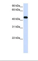 MKRN2 Antibody - Transfected 293T cell lysate. Antibody concentration: 1.0 ug/ml. Gel concentration: 12%.  This image was taken for the unconjugated form of this product. Other forms have not been tested.