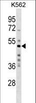 MKRN2 Antibody - MKRN2 Antibody western blot of K562 cell line lysates (35 ug/lane). The MKRN2 antibody detected the MKRN2 protein (arrow).