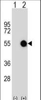 MKRN2 Antibody - Western blot of MKRN2 (arrow) using rabbit polyclonal MKRN2 Antibody. 293 cell lysates (2 ug/lane) either nontransfected (Lane 1) or transiently transfected (Lane 2) with the MKRN2 gene.