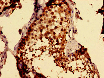 MKRN2 Antibody - Immunohistochemistry image of paraffin-embedded human testis tissue at a dilution of 1:100