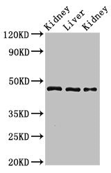 MKRN2 Antibody - Positive Western Blot detected in Rat kidney tissue, Rat liver tissue, Mouse kidney tissue. All lanes: MKRN2 antibody at 3 µg/ml Secondary Goat polyclonal to rabbit IgG at 1/50000 dilution. Predicted band size: 47, 42 KDa. Observed band size: 47 KDa