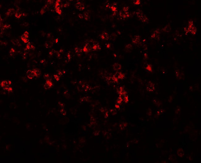 MKRN3 Antibody - Immunofluorescence of MKRN3 in human spleen tissue with MKRN3 antibody at 20 ug/mL.