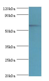 MKS1 Antibody - Western blot. All lanes: MKS1 antibody at 6 ug/ml+HeLa whole cell lysate. Secondary antibody: Goat polyclonal to rabbit at 1:10000 dilution. Predicted band size: 65 kDa. Observed band size: 65 kDa.