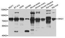 MKS1 Antibody - Western blot analysis of extract of various cells.