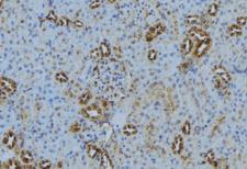 MKS1 Antibody - 1:100 staining mouse kidney tissue by IHC-P. The sample was formaldehyde fixed and a heat mediated antigen retrieval step in citrate buffer was performed. The sample was then blocked and incubated with the antibody for 1.5 hours at 22°C. An HRP conjugated goat anti-rabbit antibody was used as the secondary.