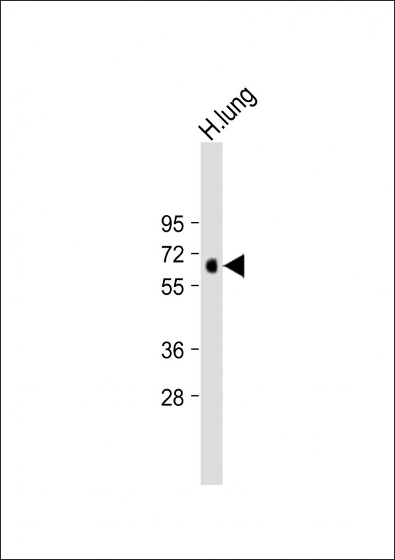 MKS1 Antibody - Anti-MKS1 Antibody (N-Term) at 1:2000 dilution + Human lung lysate Lysates/proteins at 20 µg per lane. Secondary Goat Anti-Rabbit IgG, (H+L), Peroxidase conjugated at 1/10000 dilution. Predicted band size: 65 kDa Blocking/Dilution buffer: 5% NFDM/TBST.