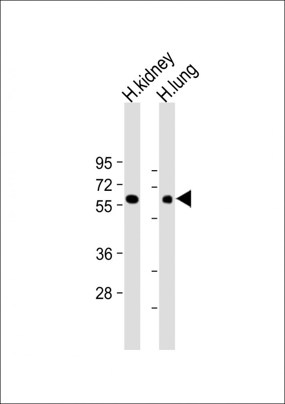 MKS1 Antibody - All lanes: Anti-MKS1 Antibody (N-Term) at 1:2000 dilution Lane 1: Human kidney lysate Lane 2: Human lung lysate Lysates/proteins at 20 µg per lane. Secondary Goat Anti-Rabbit IgG, (H+L), Peroxidase conjugated at 1/10000 dilution. Predicted band size: 65 kDa Blocking/Dilution buffer: 5% NFDM/TBST.