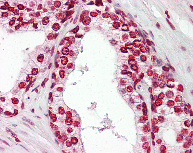 MKX Antibody - Anti-MKX antibody IHC of human prostate. Immunohistochemistry of formalin-fixed, paraffin-embedded tissue after heat-induced antigen retrieval. Antibody dilution 2.5-5 ug/ml. This image was taken for the unconjugated form of this product. Other forms have not been tested.