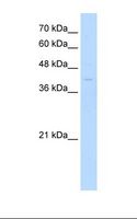 MKX Antibody - Jurkat cell lysate. Antibody concentration: 0.5 ug/ml. Gel concentration: 12%.  This image was taken for the unconjugated form of this product. Other forms have not been tested.