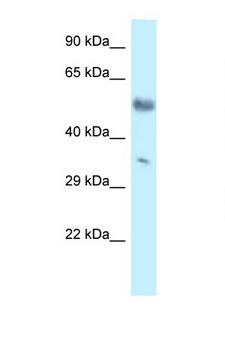 MKX Antibody - MKX antibody Western blot of Mouse Brain lysate. Antibody concentration 1 ug/ml.  This image was taken for the unconjugated form of this product. Other forms have not been tested.
