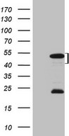 MKX Antibody - HEK293T cells were transfected with the pCMV6-ENTRY control (Left lane) or pCMV6-ENTRY MKX (Right lane) cDNA for 48 hrs and lysed. Equivalent amounts of cell lysates (5 ug per lane) were separated by SDS-PAGE and immunoblotted with anti-MKX (1:2000).