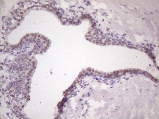 MKX Antibody - Immunohistochemical staining of paraffin-embedded Human prostate tissue within the normal limits using anti-MKX mouse monoclonal antibody. (Heat-induced epitope retrieval by 1 mM EDTA in 10mM Tris, pH8.5, 120C for 3min. (1:150)