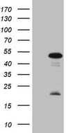 MKX Antibody - HEK293T cells were transfected with the pCMV6-ENTRY control. (Left lane) or pCMV6-ENTRY MKX. (Right lane) cDNA for 48 hrs and lysed. Equivalent amounts of cell lysates. (5 ug per lane) were separated by SDS-PAGE and immunoblotted with anti-MKX. (1:2000)