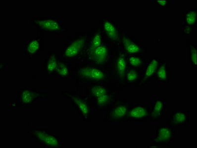 MKX Antibody - Immunofluorescence staining of Hela cells at a dilution of 1:133, counter-stained with DAPI. The cells were fixed in 4% formaldehyde, permeabilized using 0.2% Triton X-100 and blocked in 10% normal Goat Serum. The cells were then incubated with the antibody overnight at 4 °C.The secondary antibody was Alexa Fluor 488-congugated AffiniPure Goat Anti-Rabbit IgG (H+L) .
