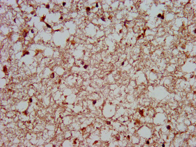 MKX Antibody - Immunohistochemistry image at a dilution of 1:400 and staining in paraffin-embedded human brain tissue performed on a Leica BondTM system. After dewaxing and hydration, antigen retrieval was mediated by high pressure in a citrate buffer (pH 6.0) . Section was blocked with 10% normal goat serum 30min at RT. Then primary antibody (1% BSA) was incubated at 4 °C overnight. The primary is detected by a biotinylated secondary antibody and visualized using an HRP conjugated SP system.