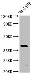 MKX Antibody - Positive Western Blot detected in SH-SY5Y whole cell lysate. All lanes: MKX antibody at 6 µg/ml Secondary Goat polyclonal to rabbit IgG at 1/50000 dilution. Predicted band size: 40 KDa. Observed band size: 40 KDa