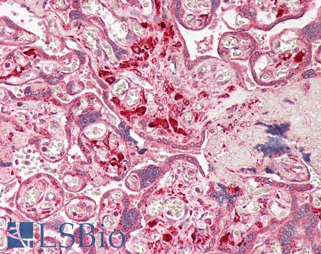 MKX Antibody - Human Placenta: Formalin-Fixed, Paraffin-Embedded (FFPE)