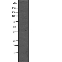 MKX Antibody - Western blot analysis of MKX expression in NCI-H460 cells line lysate. The lane on the left is treated with the antigen-specific peptide.