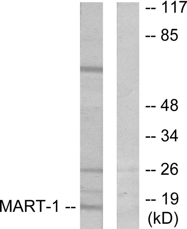 MLANA / Melan-A Antibody - Western blot analysis of lysates from NIH/3T3 cells, using MART-1 Antibody. The lane on the right is blocked with the synthesized peptide.