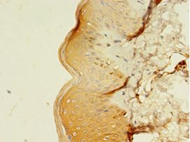 MLANA / Melan-A Antibody - Immunohistochemistry of paraffin-embedded human skin tissue using antibody at 1:100 dilution.  This image was taken for the unconjugated form of this product. Other forms have not been tested.