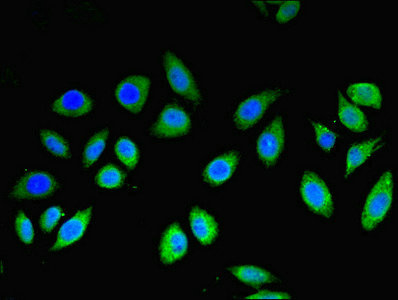 MLANA / Melan-A Antibody - Immunofluorescent analysis of A549 cells using MLANA Antibody at dilution of 1:100 and Alexa Fluor 488-congugated AffiniPure Goat Anti-Rabbit IgG(H+L)