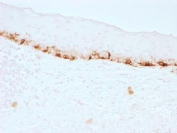 MLANA / Melan-A Antibody - IHC testing of FFPE human skin stained with MART-1 antibody (clone M2-7C10). Note cytoplasmic staining of cells. HIER: boil tissue sections in 10mM citrate buffer, pH 6, for 10-20 min.