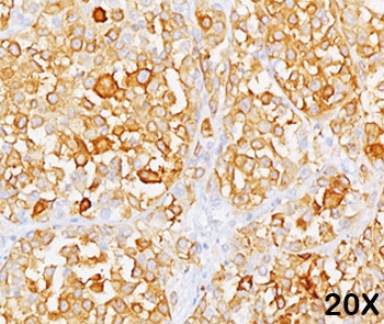 MLANA / Melan-A Antibody - MART-1 Melan-A antibody M2-9E3 immunohistochemistry 2.  This image was taken for the unmodified form of this product. Other forms have not been tested.