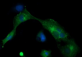 MLANA / Melan-A Antibody - Anti-MLANA mouse monoclonal antibody immunofluorescent staining of COS7 cells transiently transfected by pCMV6-ENTRY MLANA.