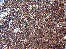 MLANA / Melan-A Antibody - IHC of paraffin-embedded Human lymph node tissue using anti-MLANA mouse monoclonal antibody. (Heat-induced epitope retrieval by 10mM citric buffer, pH6.0, 120°C for 3min).