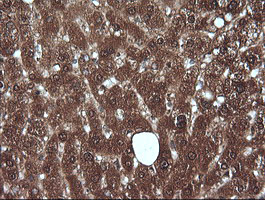 MLANA / Melan-A Antibody - IHC of paraffin-embedded Human liver tissue using anti-MLANA mouse monoclonal antibody.
