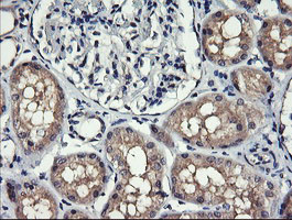 MLANA / Melan-A Antibody - IHC of paraffin-embedded Human Kidney tissue using anti-MLANA mouse monoclonal antibody.