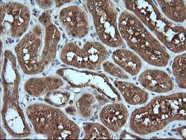 MLANA / Melan-A Antibody - IHC of paraffin-embedded Human Kidney tissue using anti-MLANA mouse monoclonal antibody.