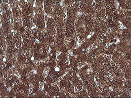 MLANA / Melan-A Antibody - IHC of paraffin-embedded Human liver tissue using anti-MLANA mouse monoclonal antibody.